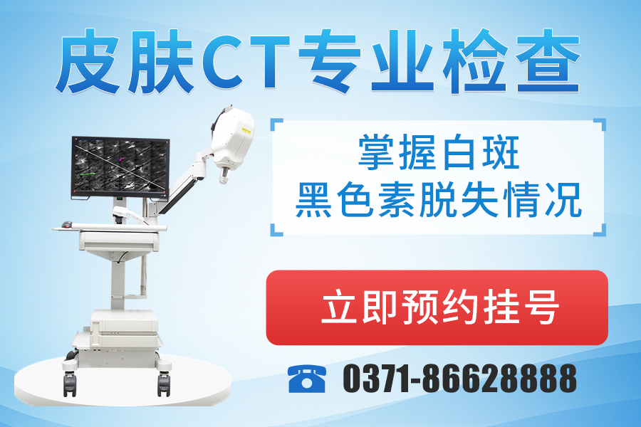 郑州西京白癜风医院 郑州西京白癜风医院