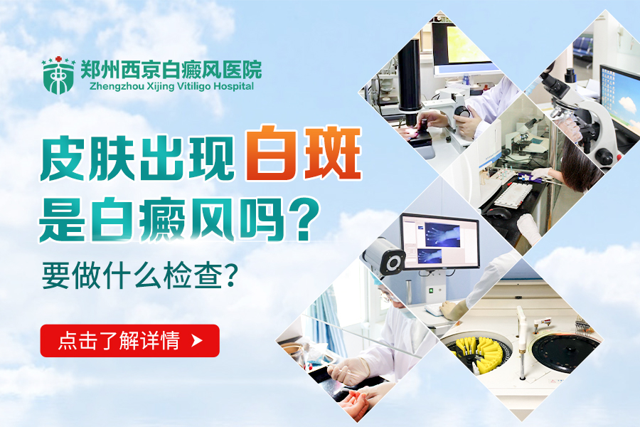 郑州西京白癜风医院 郑州西京白癜风医院