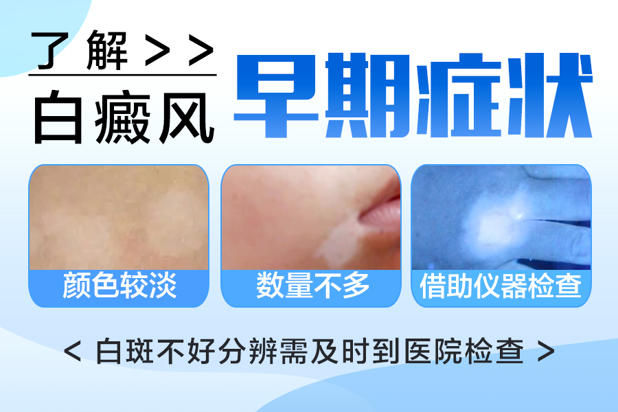 郑州西京白癜风医院 郑州西京白癜风医院